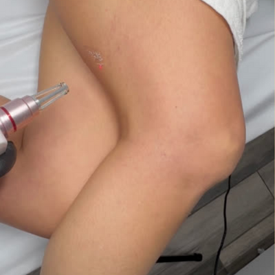 Pretty Woman Studio Laser Images (4)